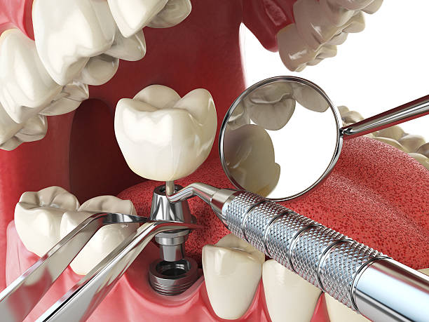 Best Emergency Dental Care for Sports Injuries in Mogul, NV